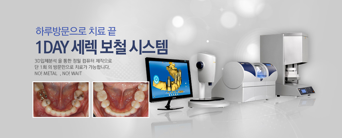 (Cerec)